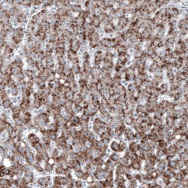 Staining of human liver shows moderate granular cytoplasmic positivity in hepatocytes.