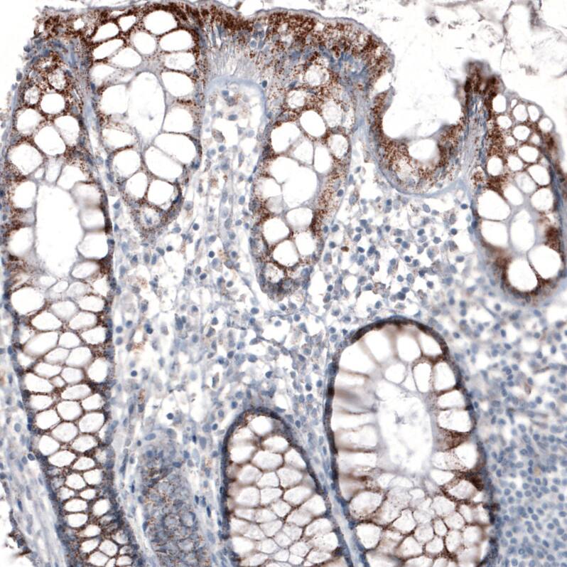 Staining of human rectum shows moderate granular cytoplasmic positivity in glandular cells.