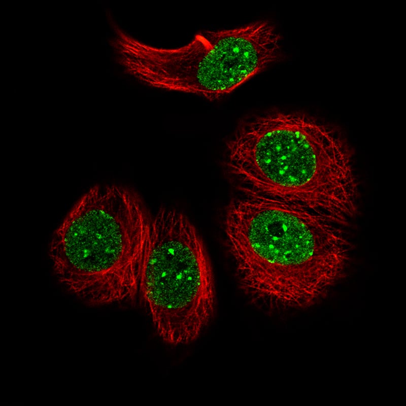 Staining of MCF7 cells, showing specific staining in nuclear bodies and in the nucleoplasm in green. Microtubule and nuclear probes are visualized in red and blue, respectively.