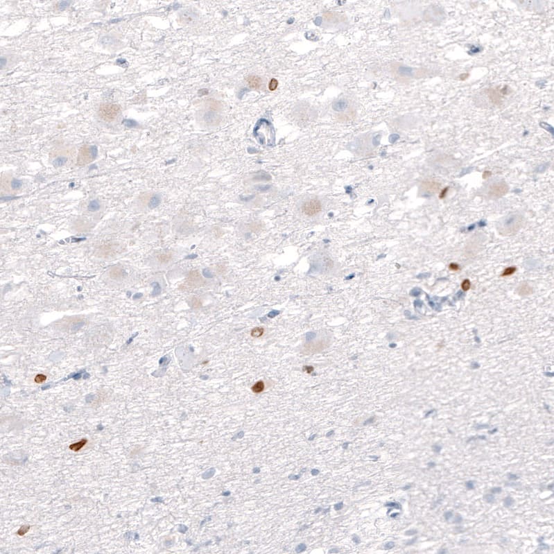 Staining of human hypothalamus shows strong nuclear positivity in a subset of neurons.