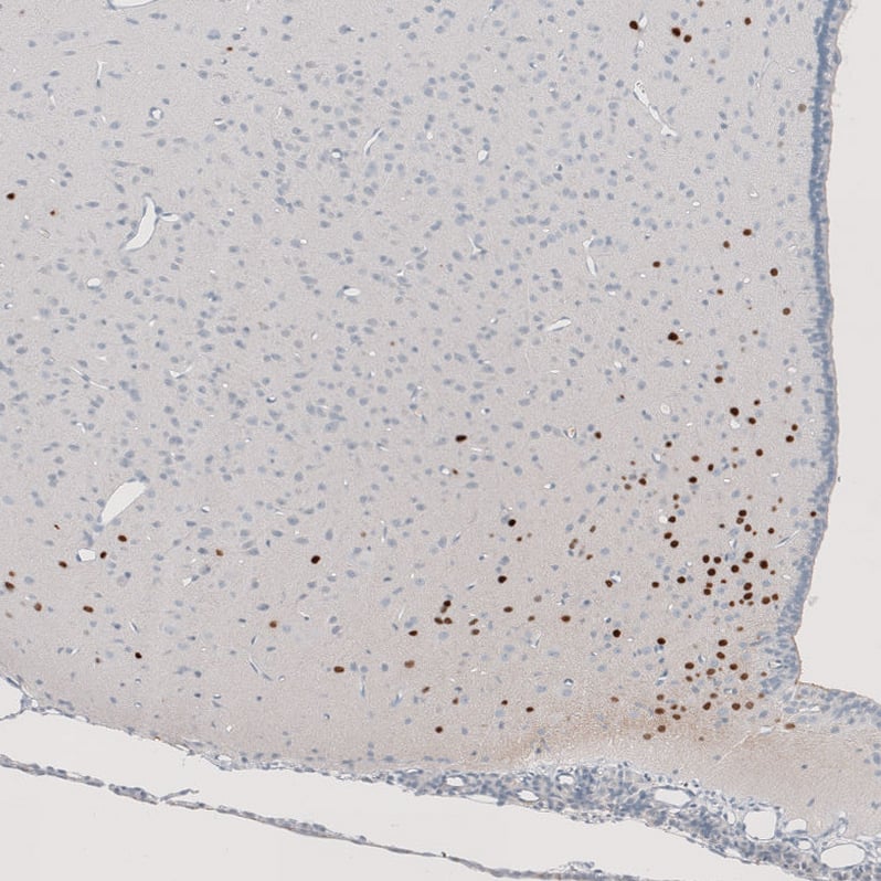 Staining of rat hypothalamus shows strong nuclear positivity in a subset of neurons.