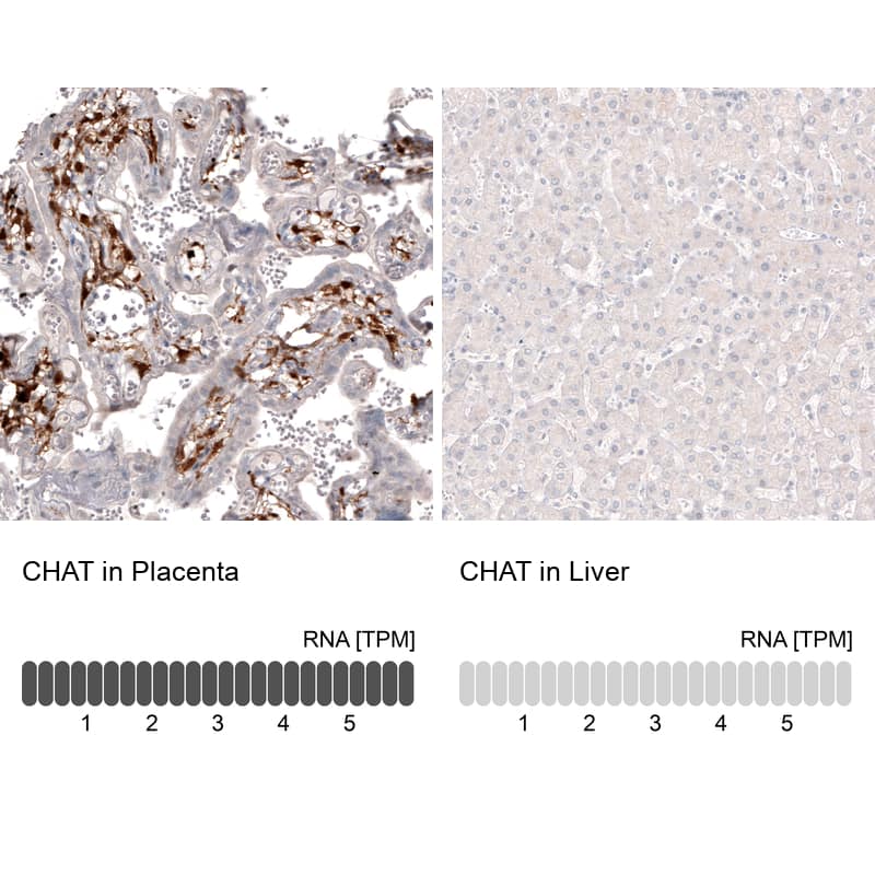 Analysis in human placenta and liver tissues. Corresponding Choline Acetyltransferase/ChAT RNA-seq data are presented for the same tissues.