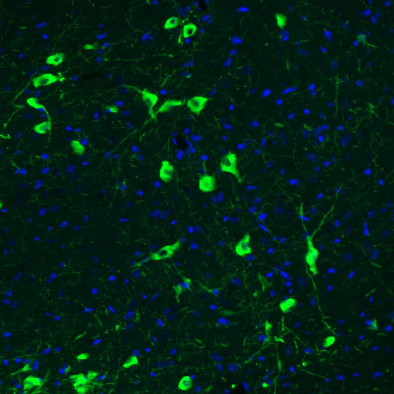Staining of rat brain shows strong positivity in acetylcholine neurons in the basal forebrain.