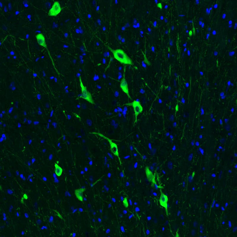 Staining of rat brain shows strong positivity in acetylcholine neurons in the medial septum.