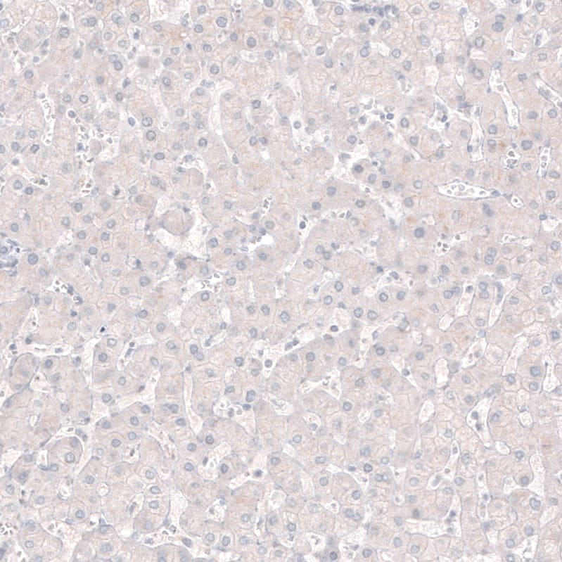 Staining of human liver shows no positivity in hepatocytes as expected.