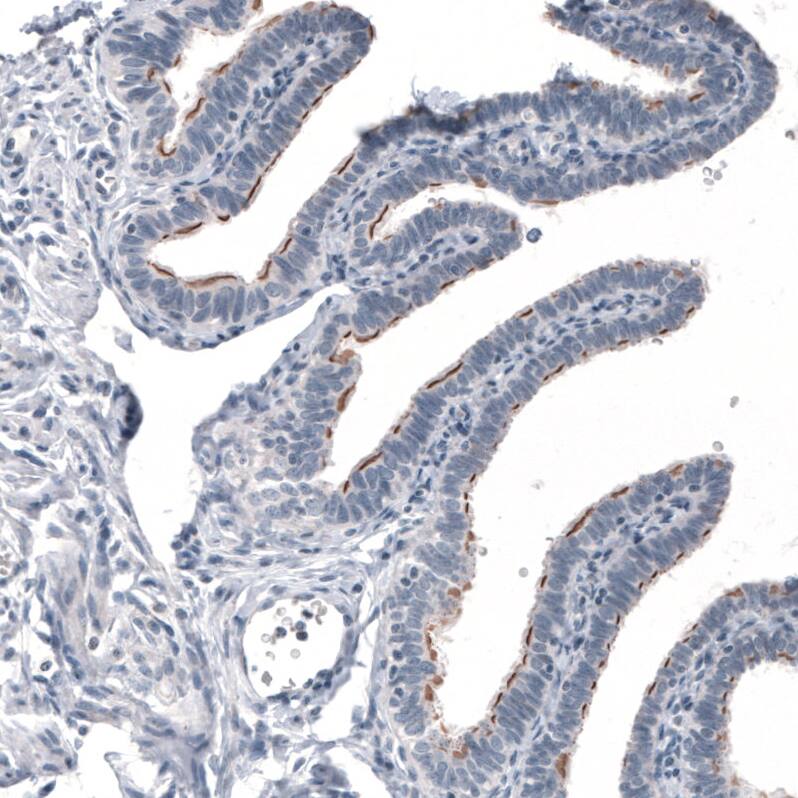 Staining of human fallopian tube shows moderate positivity in the basal bodies of cilia in glandular cells.