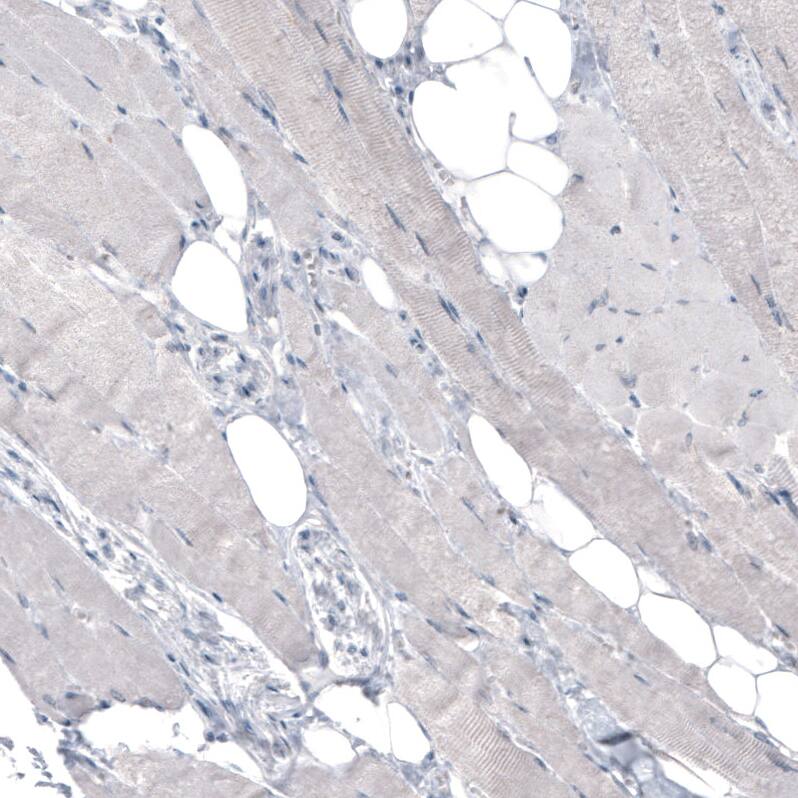 Staining of human skeletal muscle shows no positivity in myocytes as expected.