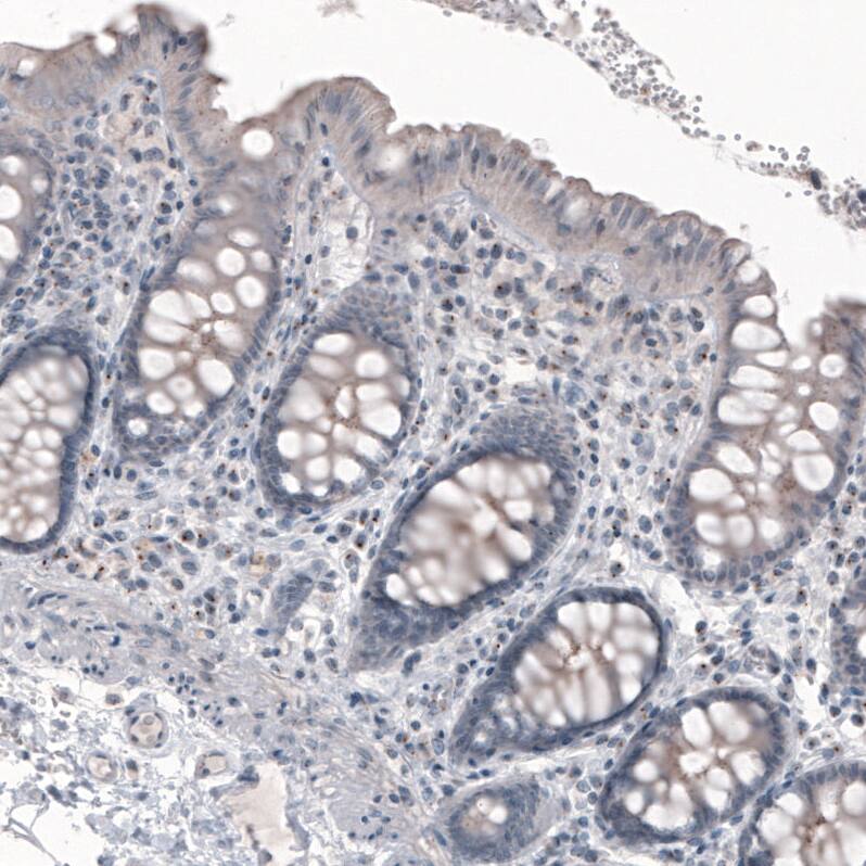 Immunohistochemistry CEP350 Antibody (CL3423)