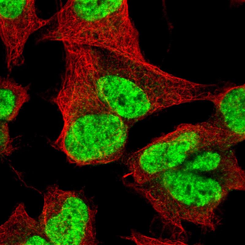 Staining of SH-SY5Y cells showing specific staining in the nucleoplasm in green. Microtubule- and nuclear probes are visualized in red and blue, respectively (where available). 