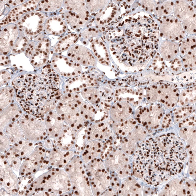 Staining of human kidney shows strong nuclear positivity in cells in glomeruli and tubuli.
