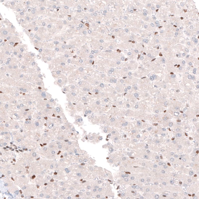 Staining of human liver shows moderate nuclear positivity in leukocytes and no positivity in hepatocytes.