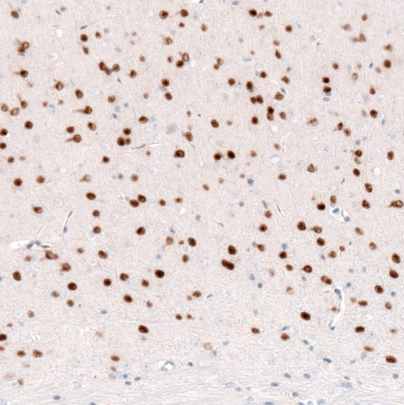 Staining of mouse cerebral cortex shows strong nuclear positivity in layer 6 neurons.