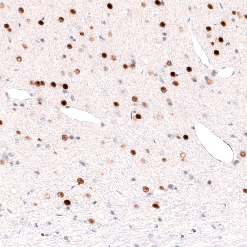 Staining of rat cerebral cortex shows strong nuclear positivity in layer 6 neurons.