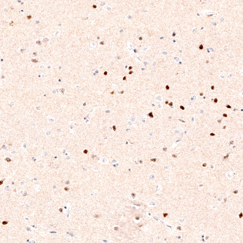Staining of human cerebral cortex shows strong nuclear positivity in layer 6 neurons.