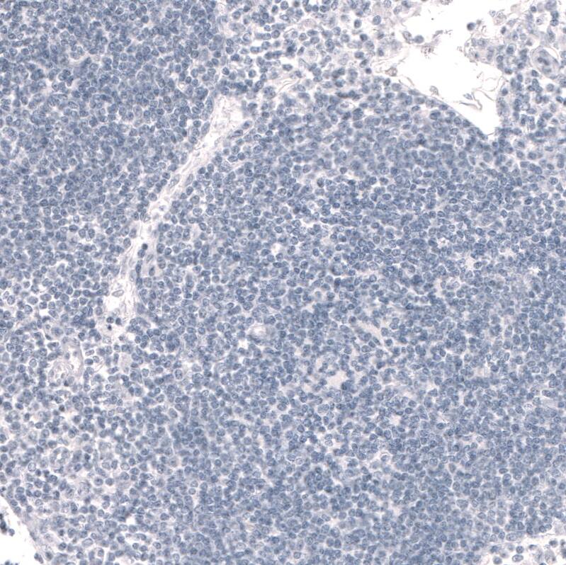 Staining of human lymph node shows no positivity in non-germinal center cells as expected.