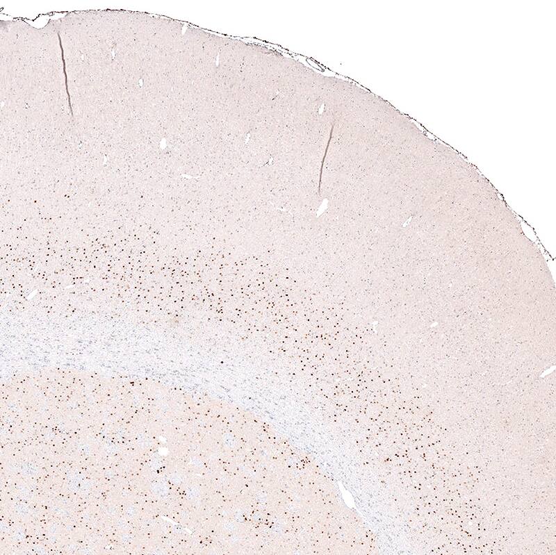 Staining of rat brain shows strong nuclear positivity in layer 6 cortical neurons, as well as in neurons in caudato-putamen.