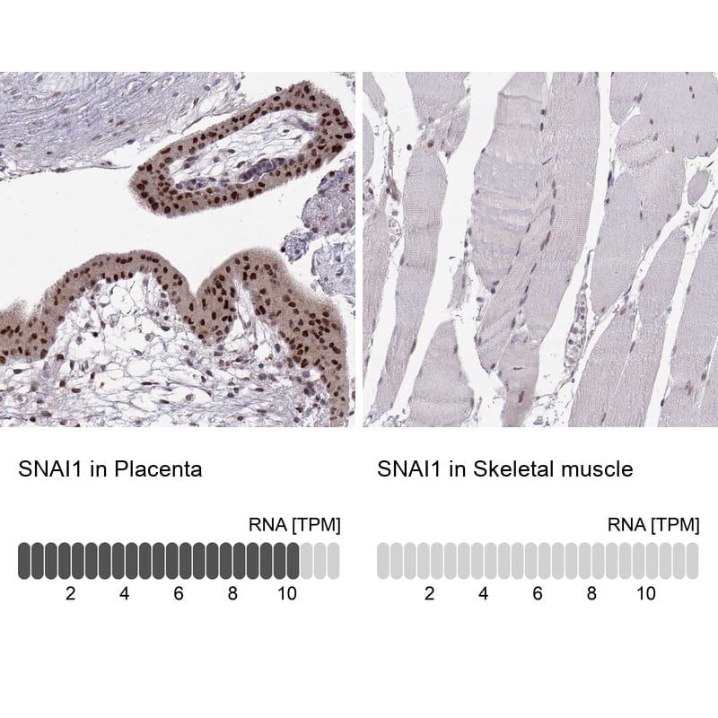 Analysis in human placenta and skeletal muscle tissues. Corresponding Snail RNA-seq data are presented for the same tissues.
