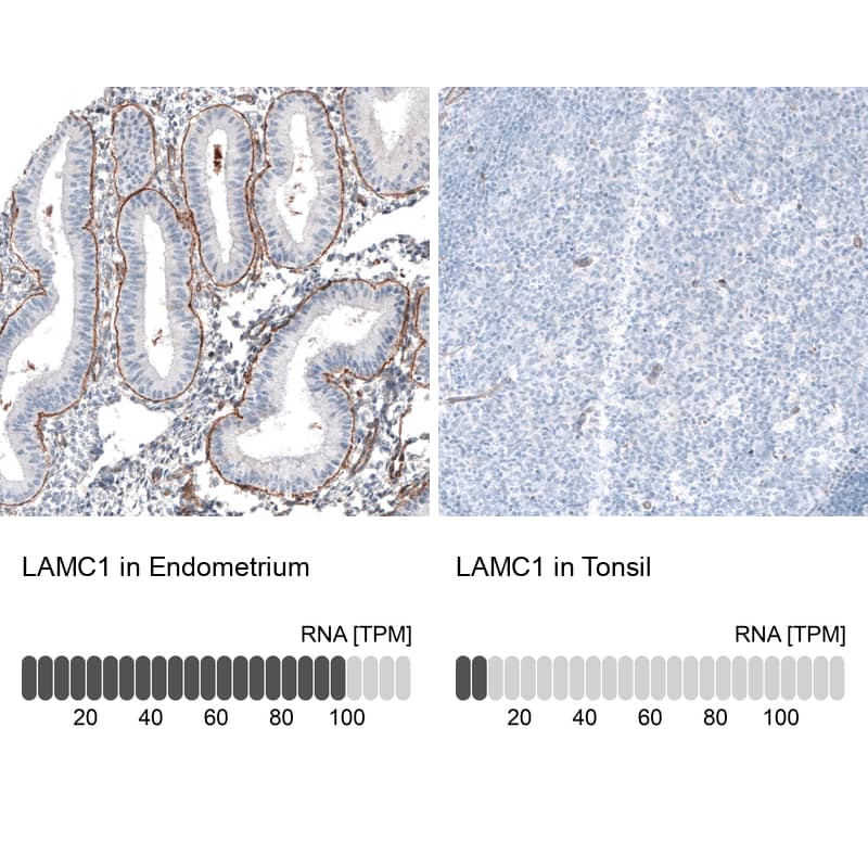 Analysis in human endometrium and tonsil tissues. Corresponding Laminin gamma 1 RNA-seq data are presented for the same tissues.