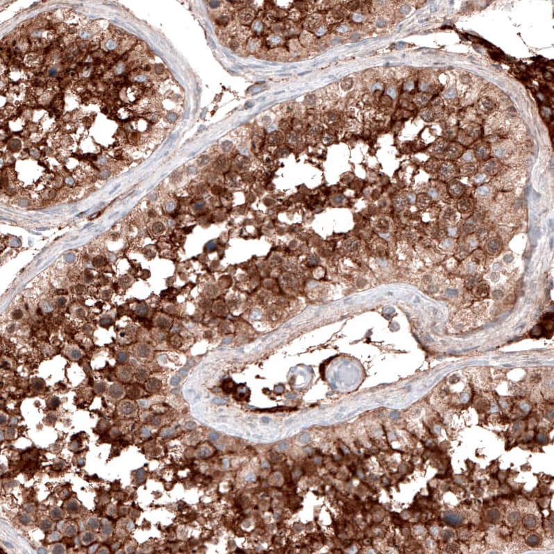 Staining of human testis shows strong membranous positivity in cells in seminiferous ducts.