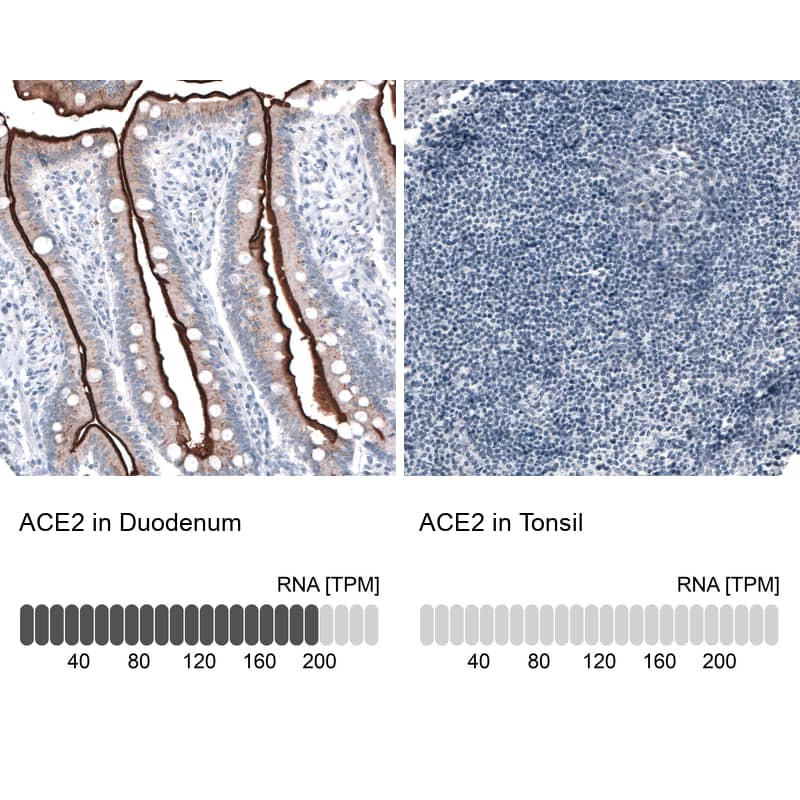 Analysis in human duodenum and tonsil tissues. Corresponding ACE-2 RNA-seq data are presented for the same tissues.