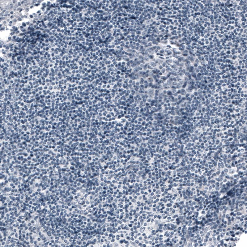 Staining of human tonsil shows no positivity in non-germinal center cells as expected.