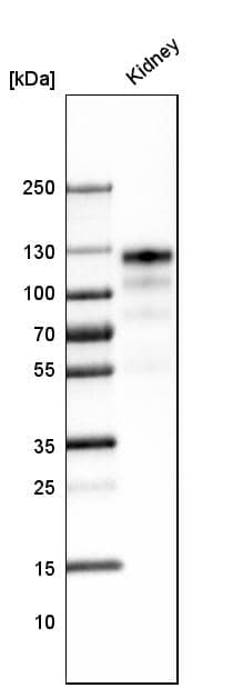 Analysis in human kidney tissue.