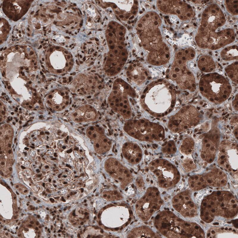 Staining of human kidney shows strong cytoplasmic and nuclear positivity in renal tubules and glomeruli.