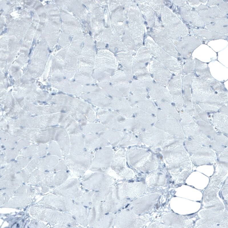 Staining of human skeletal muscle shows no positivity in myocytes as expected.