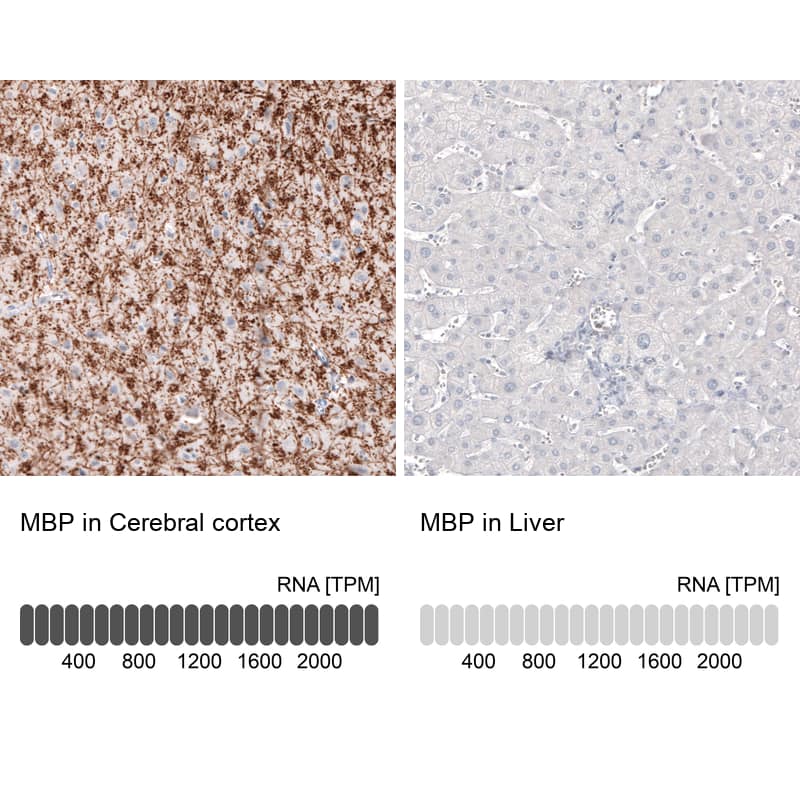 Analysis in human cerebral cortex and liver tissues. Corresponding MBP RNA-seq data are presented for the same tissues.
