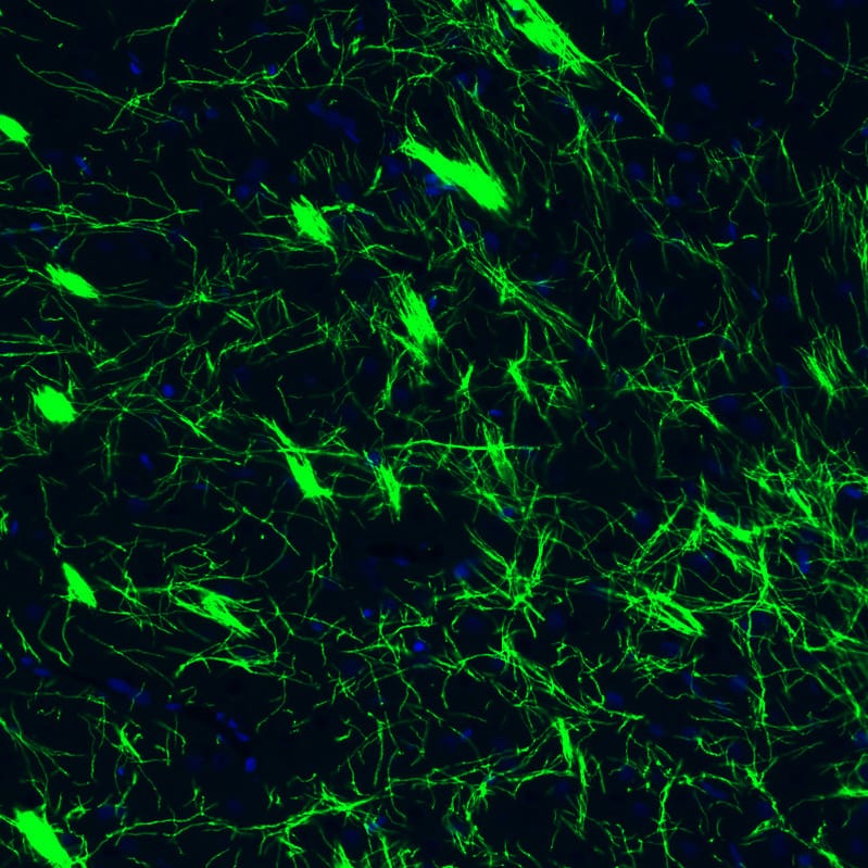 Staining of rat basal forebrain shows strong positivity in myelinated neural fibers.