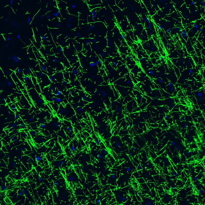 Staining of rat cerebral cortex shows strong positivity in myelinated neural fibers.
