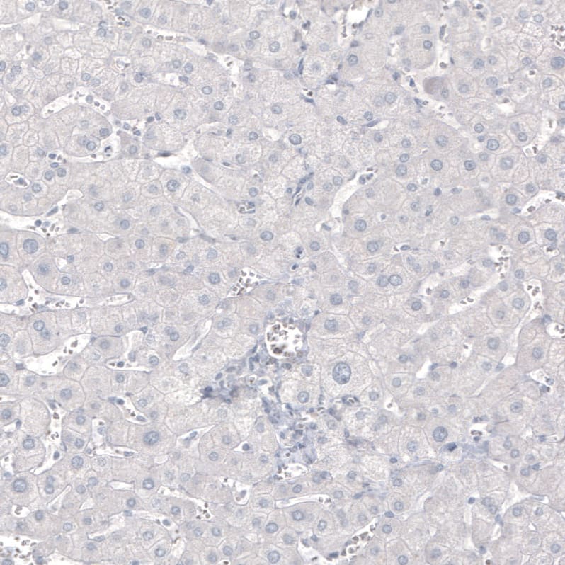 Staining of human liver shows no positivity in hepatocytes as expected.