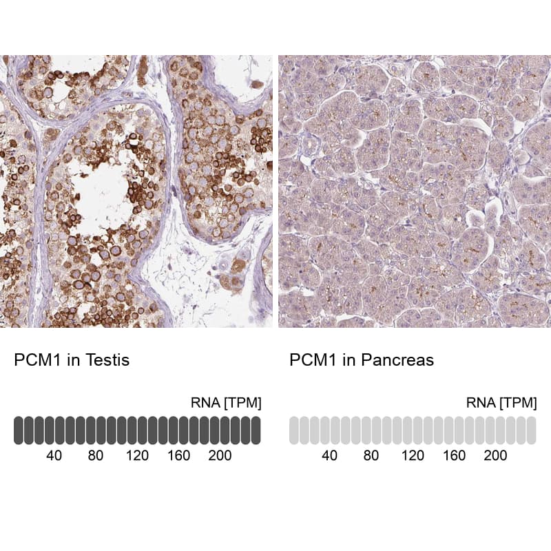 Analysis in human testis and pancreas tissues. Corresponding PCM1 RNA-seq data are presented for the same tissues.