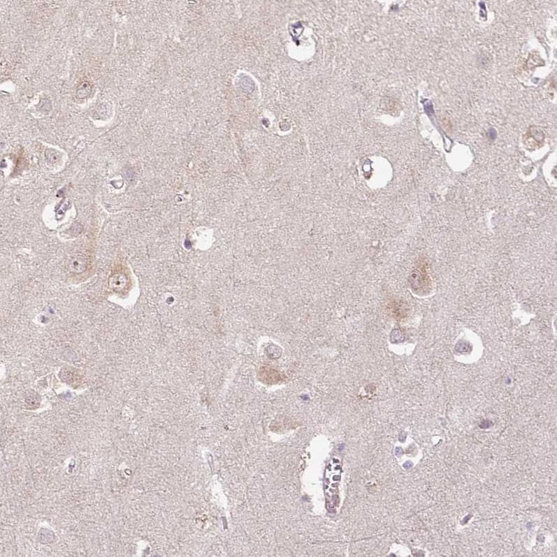 Staining of human cerebral cortex shows weak cytoplasmic positivity in neurons.