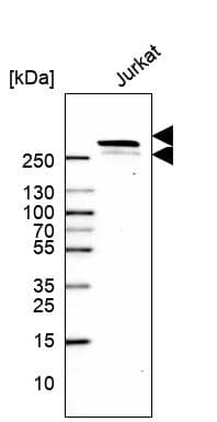 Analysis in human cell line Jurkat.