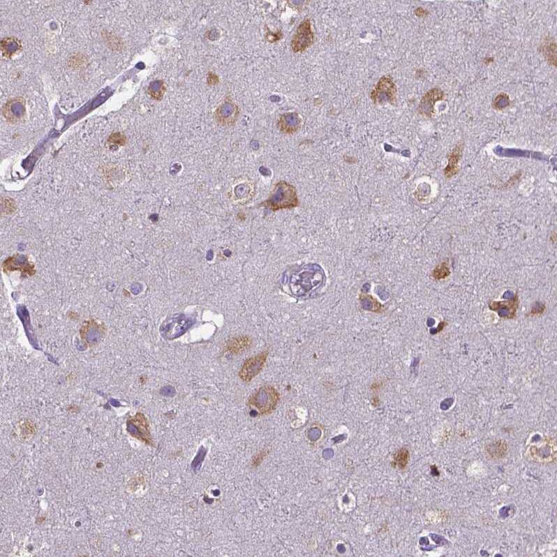 Staining of human cerebral cortex shows moderate cytoplasmic positivity in neurons.