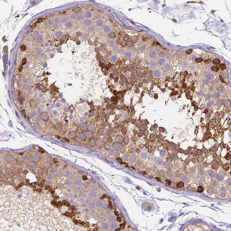 Staining of human testis shows moderate to strong cytoplasmic positivity in a subset of cells in seminiferous ducts.