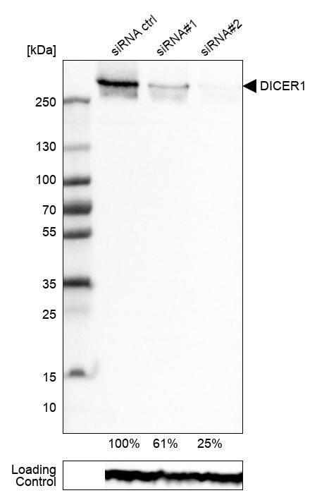 Analysis in RT-4 cells transfected with control siRNA, target specific siRNA probe #1 and #2,. Remaining relative intensity is presented. Loading control: Anti-GAPDH.