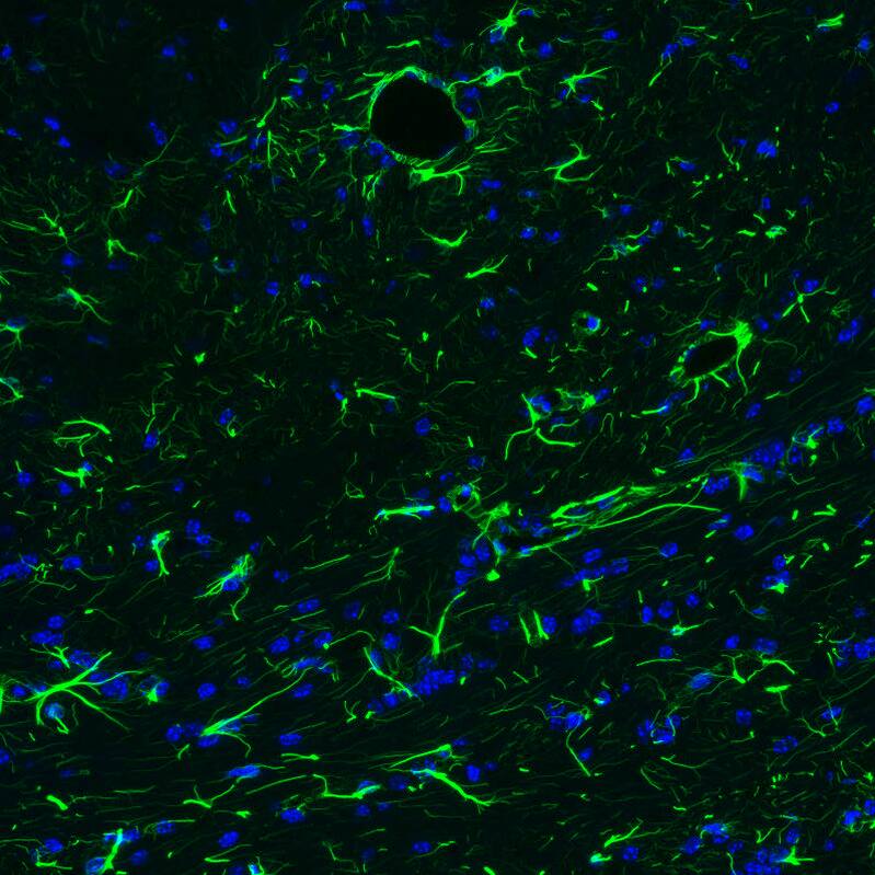 Staining of mouse brain shows strong positivity in astrocytes in the brainstem.