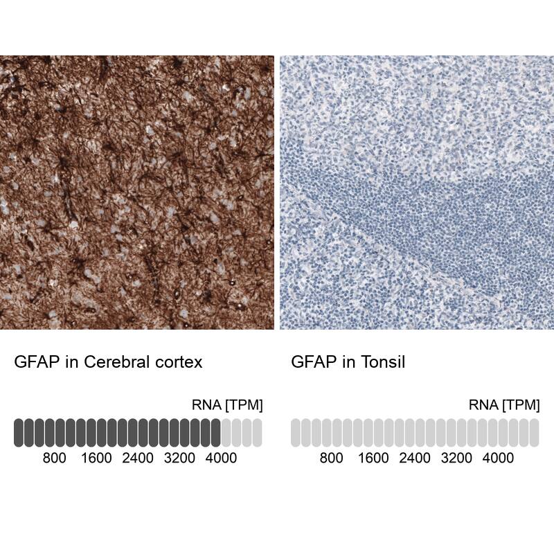 Analysis in human cerebral cortex and tonsil tissues. Corresponding GFAP RNA-seq data are presented for the same tissues.