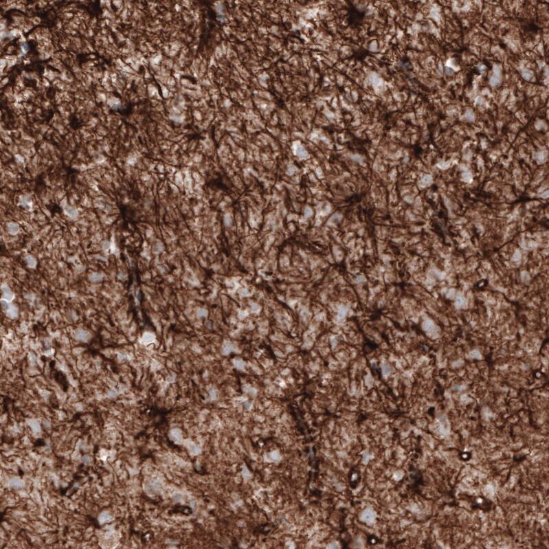 Staining of human cerebral cortex shows strong cytoplasmic positivity in astrocytes.