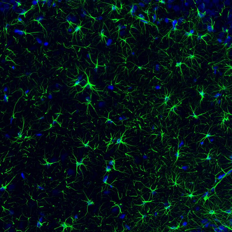 Staining of rat brain shows strong positivity in astrocytes in the hippocampus.