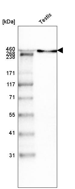 Analysis in human testis tissue.
