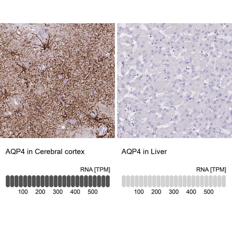 Analysis in human cerebral cortex and liver tissues. Corresponding Aquaporin-4 RNA-seq data are presented for the same tissues.