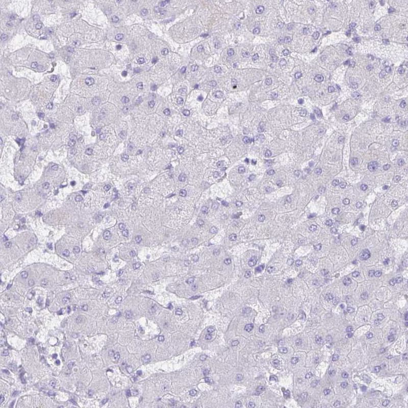 Staining of human liver shows no positivity in hepatocytes as expected.