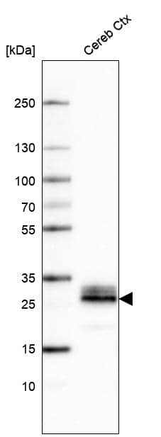 Analysis in human cerebral cortex tissue.