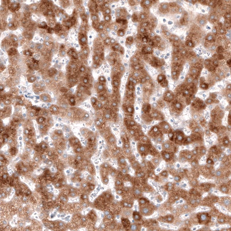 Staining of human liver shows moderate cytoplasmic positivity in hepatocytes.