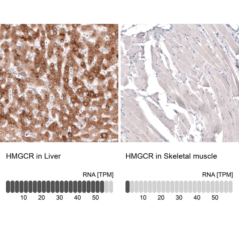 Analysis in human liver and skeletal muscle tissues. Corresponding HMG-CoA Reductase/HMGCR RNA-seq data are presented for the same tissues.