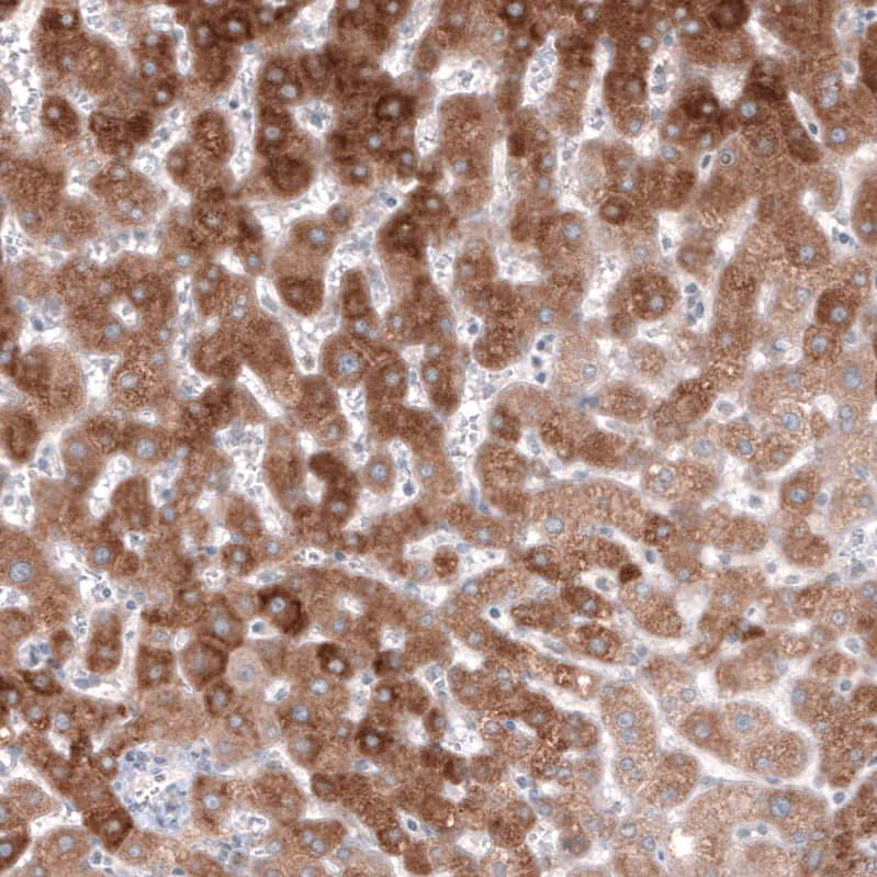 Staining of human liver shows moderate cytoplasmic positivity in hepatocytes.
