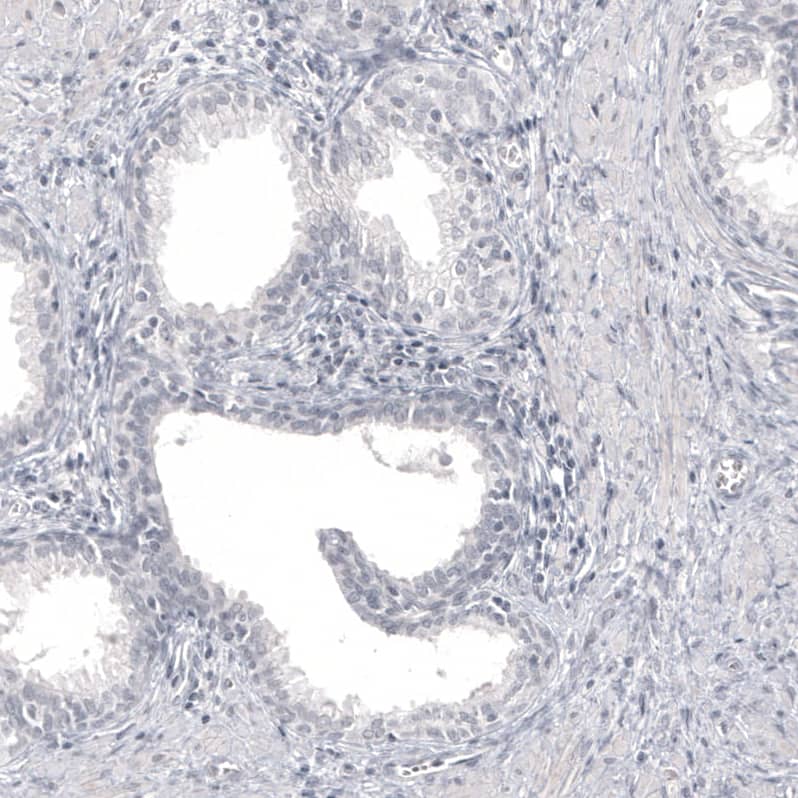 Staining of human prostate shows no positivity in glandular cells as expected.